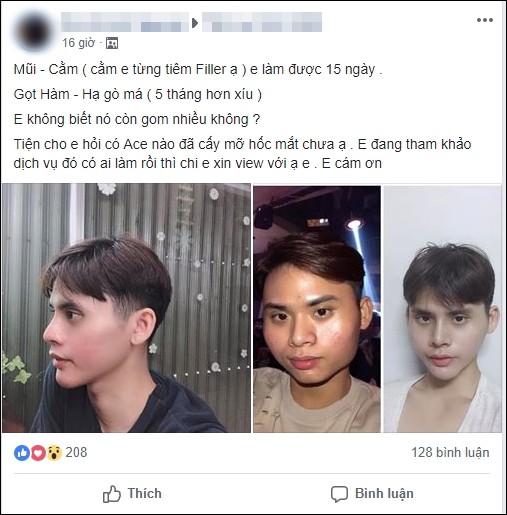 Chi 160 triệu và cả tháng trời không thể đánh răng: Câu chuyện về chàng trai trẻ PTTM vì nỗi tự ti mặt vuông gây sốt cộng đồng mạng