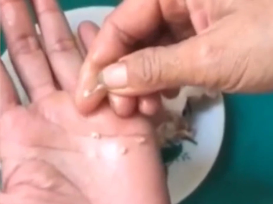 Nghi án dùng thịt lợn có sán chưa dứt, trường mầm non bị tố nhập thịt gà hôi thối