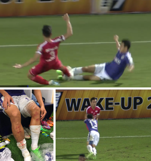 Sau án phạt nội bộ, Quế Ngọc Hải chuẩn bị đón thêm hung tin?