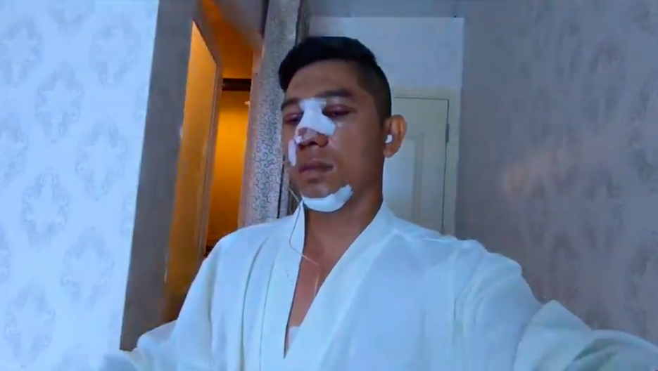 Bị ném đá vì công khai gương mặt 100% thẩm mỹ, Lương Bằng Quang bức xúc đáp trả Bị ném đá vì công khai gương mặt 100% thẩm mỹ, Lương Bằng Quang bức xúc đáp trả