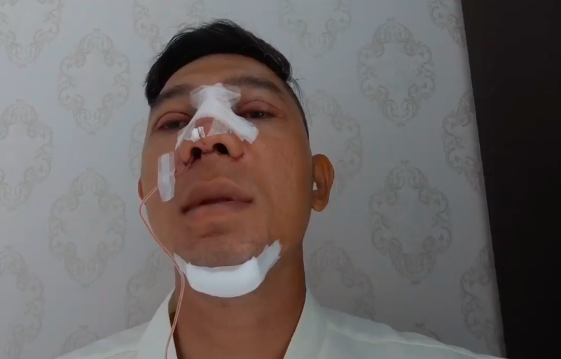 Bị ném đá vì công khai gương mặt 100% thẩm mỹ, Lương Bằng Quang bức xúc đáp trả