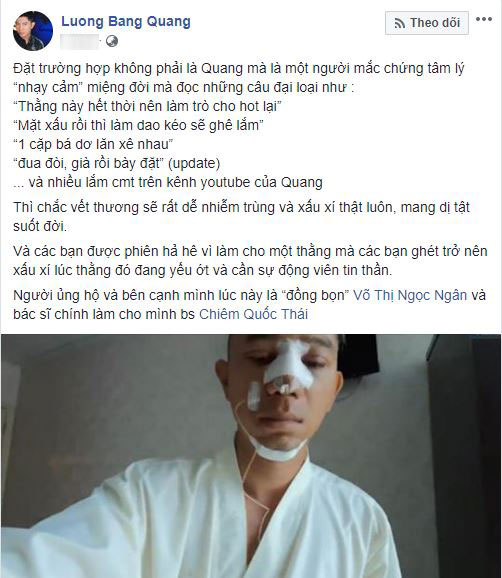 Bị ném đá vì công khai gương mặt 100% thẩm mỹ, Lương Bằng Quang bức xúc đáp trả