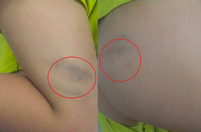 Cô giáo bị phụ huynh tố đánh học sinh: Tôi rất ân hận