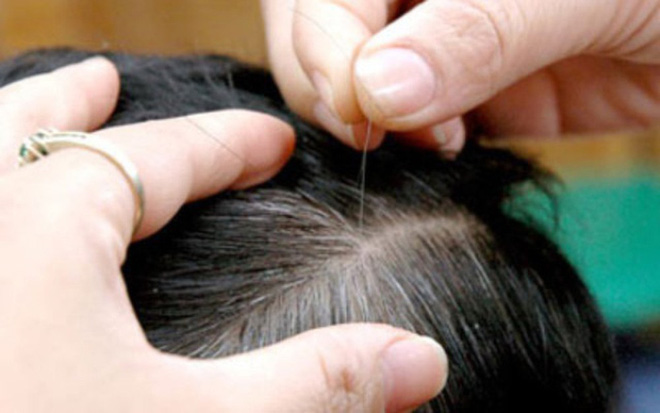 Tóc bạc có nên nhổ: Bác sĩ khẳng định không nên vì rất nhiều tác hại