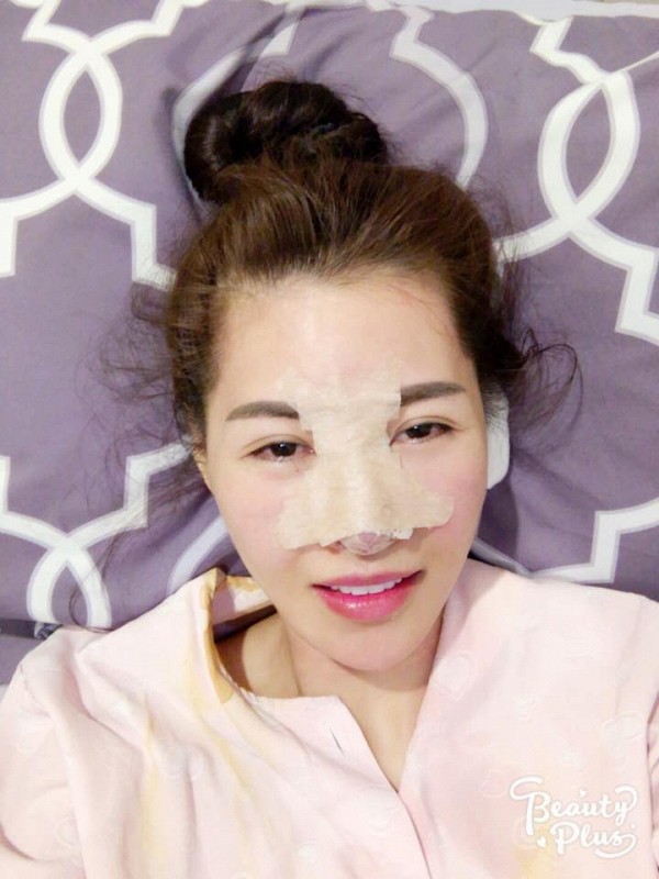 Chuyện dao kéo của sao Vbiz: Người 20 ca đại phẫu mà cơ thể đang xuống cấp, kẻ U40 vẫn quyết cải thiện vẻ ngoài