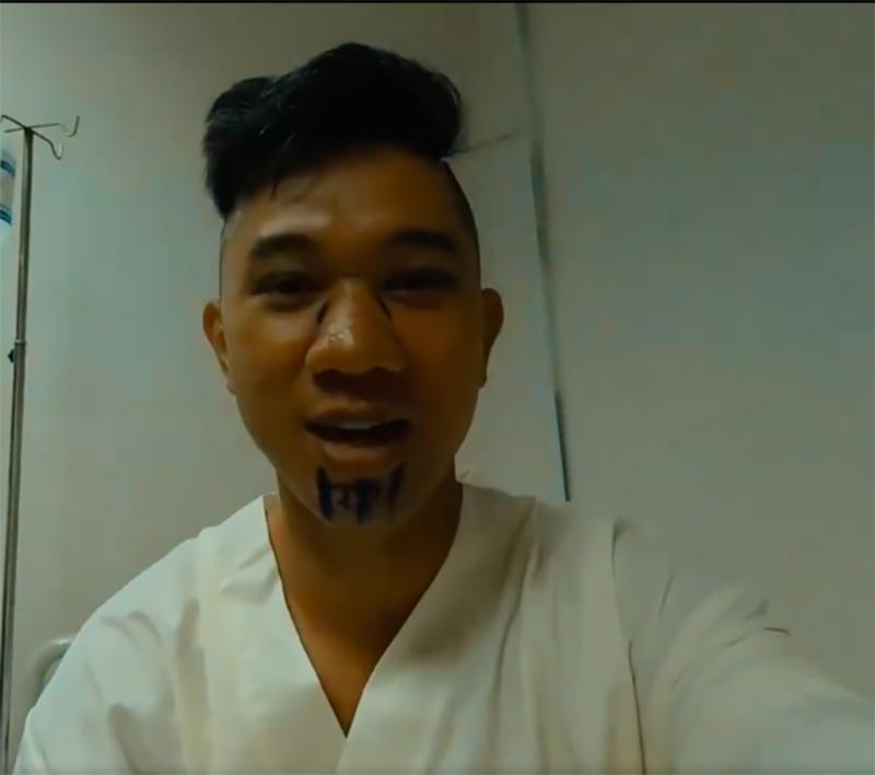 Chuyện dao kéo của sao Vbiz: Người 20 ca đại phẫu mà cơ thể đang xuống cấp, kẻ U40 vẫn quyết cải thiện vẻ ngoài