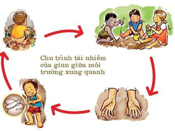 HI HỮU: Bé 3 tuổi đau bụng vật vã từng cơn, bác sĩ lấy ra cả túi giun kết thành từng búi to