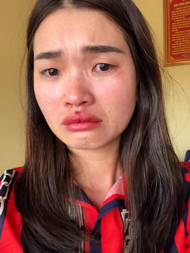 Nữ hành khách tố bị nhân viên nhà xe hành hung: Tài xế khai gì tại CQĐT?