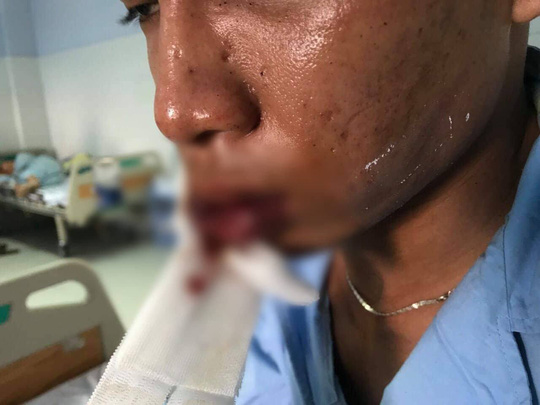 Băng giang hồ đòi bảo kê quán cà phê ở Bình Chánh sa lưới