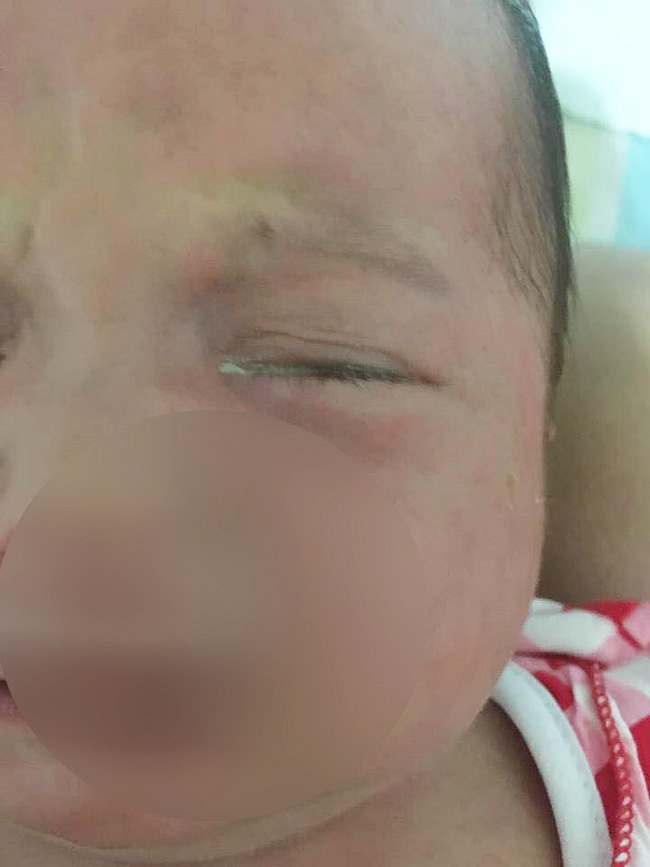 Nhói lòng với chuyện vợ chồng trẻ vội đưa con đi khám giữa trời nắng, lỡ đâm xe bị ông chú ép đền 3 triệu