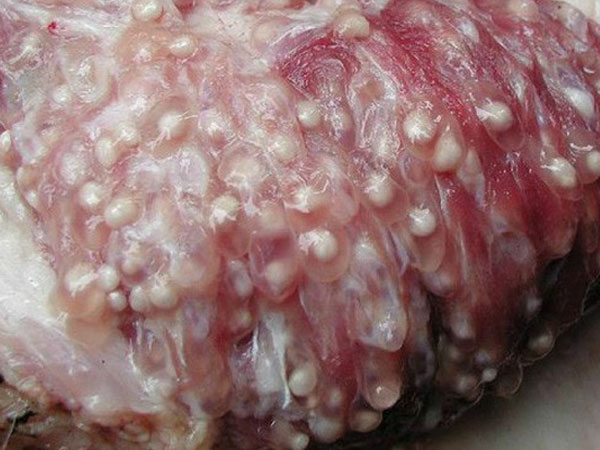 Thịt lợn nhiễm sán: Nếu nấu chín sán sẽ chết, vậy sán lợn sẽ lây qua con đường nào?