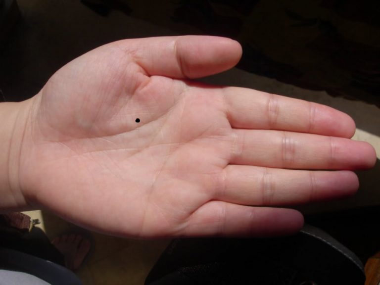 Người có nốt ruồi Ở BÀN TAY nhất định phải biết điều này để rõ đường tài vận cát- hung