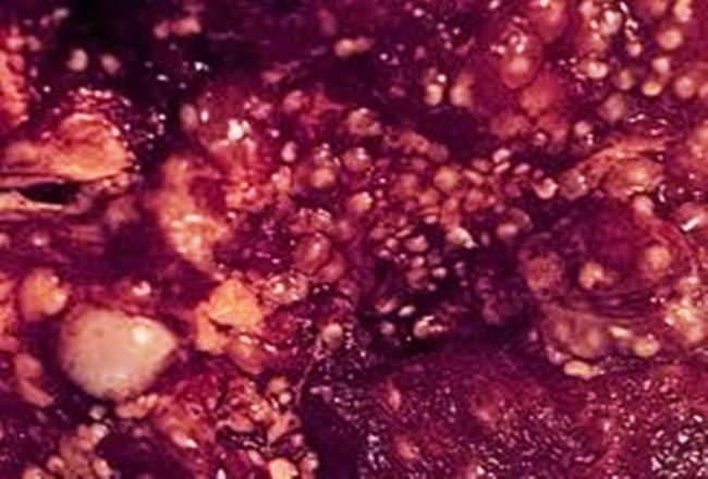 Ăn rau bẩn nguy cơ nhiễm sán kinh khủng hơn gấp bội: Làm sao để phòng ngừa bệnh sán?