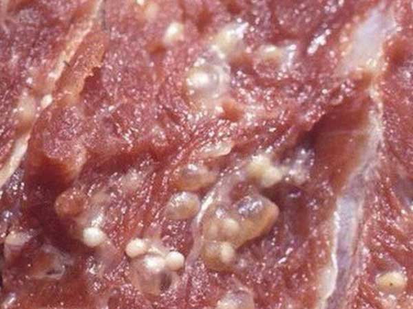 Không có ý nghĩa điều trị, vì sao vẫn để hàng ngàn trẻ xét nghiệm Elisa tìm sán lợn?