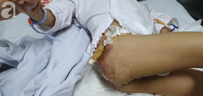 Mẹ khóc cạn nước mắt vì đứa con trai bại não bị 4 con chó cắn đứt bộ phận sinh dục