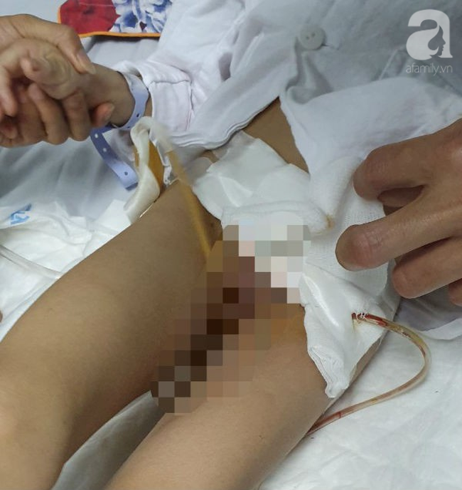 Mẹ khóc cạn nước mắt vì đứa con trai bại não bị 4 con chó cắn đứt bộ phận sinh dục