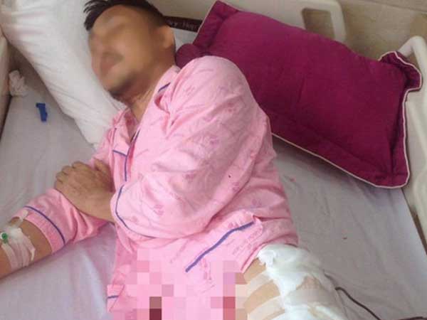 Xông vào nhà xịt hơi cay, đâm trọng thương người quen giữa ban ngày