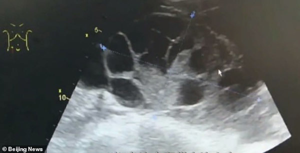 Cái kết đắng cho cô gái 20 tuổi bán trứng để mua Iphone đời mới