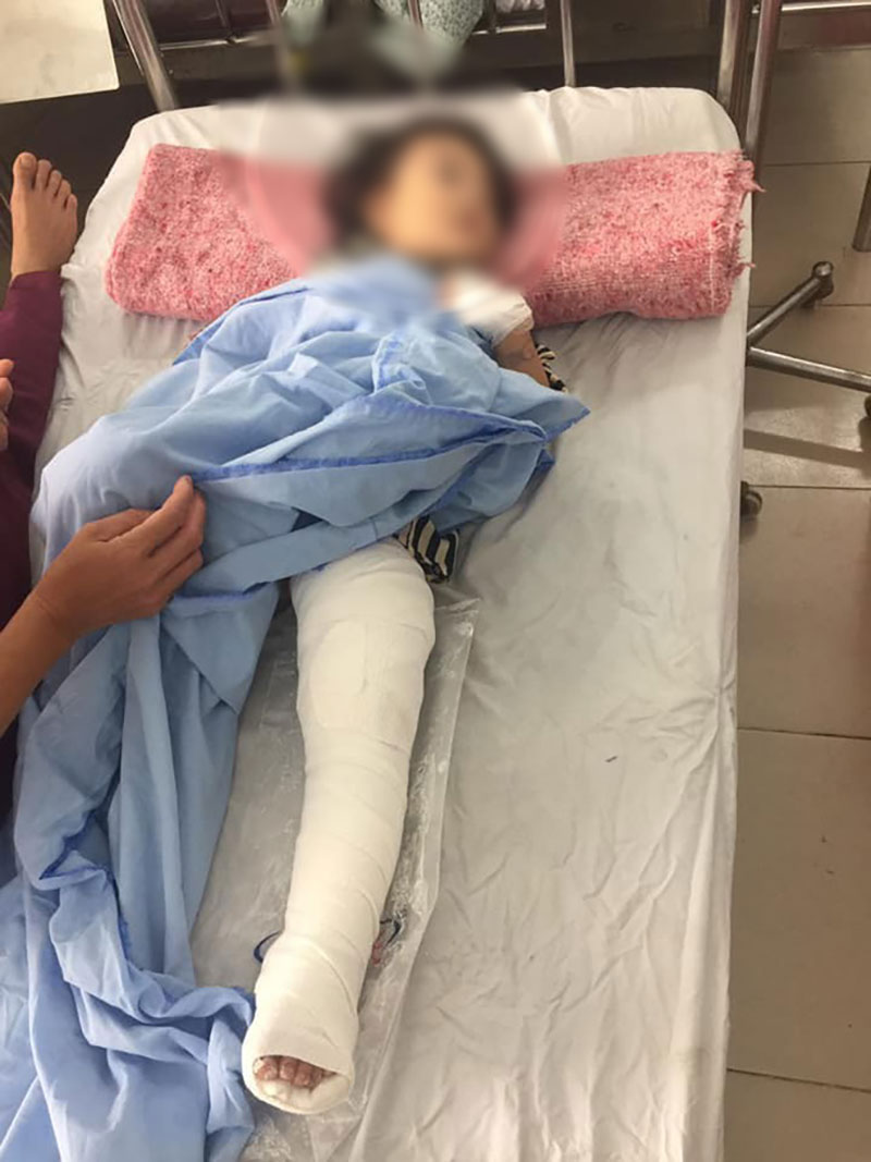 Hà Nội: Chó pitbull giật đứt xích lao vào cắn bé 2 tuổi, hàng xóm phải mang xà beng đánh chết con vật để giải cứu nạn nhân