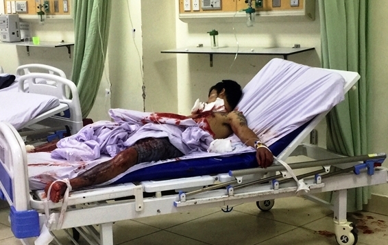 Thanh niên miền Tây tự cắt cổ, mổ ngực sau khi dùng ma túy đá