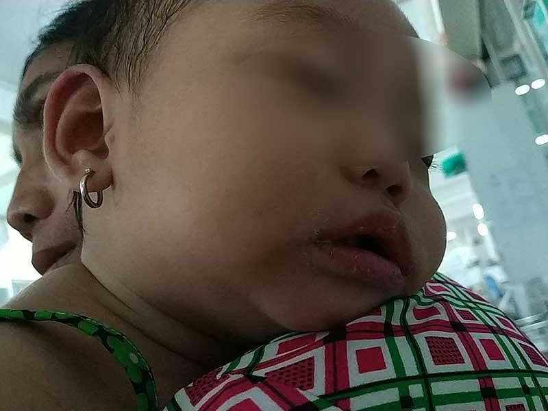 Kawasaki, bệnh lạ nguy hiểm