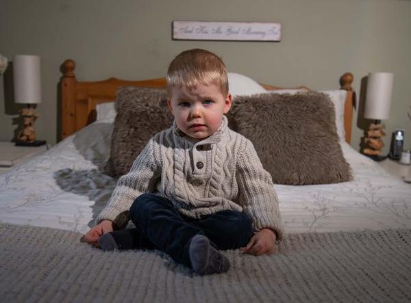 Hi hữu: Bé trai 2 tuổi bị gãy đôi xương đùi sau khi nhảy lên nhảy xuống trên giường