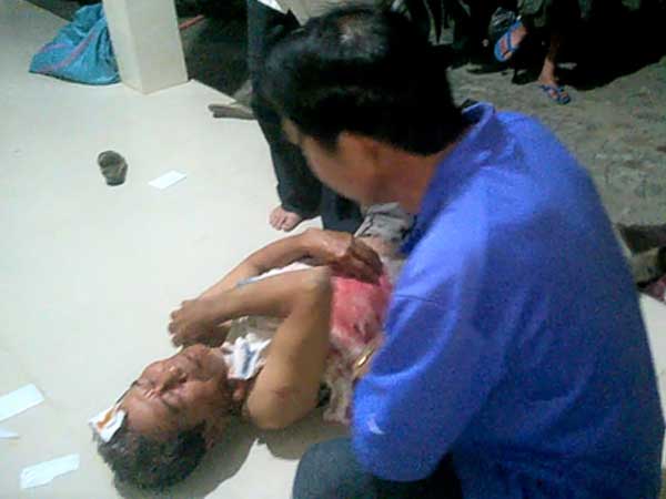 Chống cát tặc, một người dân bị chém trọng thương