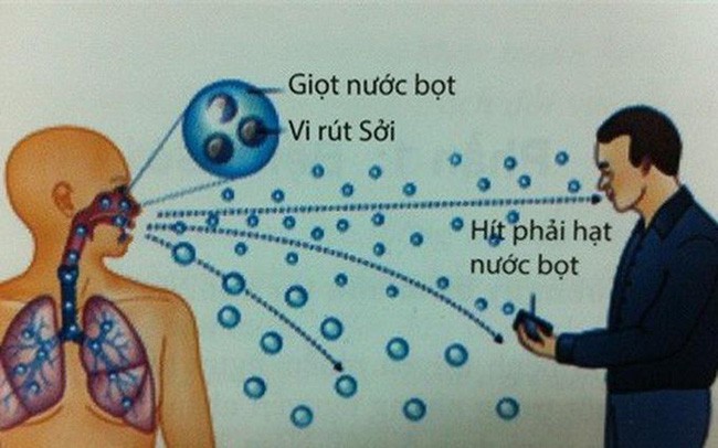 Vắc-xin có thể bảo vệ khỏi bệnh sởi, nhưng bạn cũng cần biết bệnh sởi lây qua đường nào Vắc-xin có thể bảo vệ khỏi bệnh sởi, nhưng bạn cũng cần biết bệnh sởi lây qua đường nào