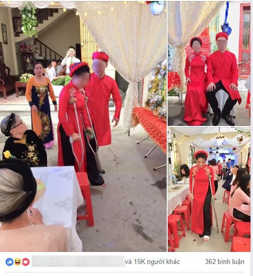 Cô dâu số nhọ bị ngã gãy chân ngay trước ngày cưới, dân tình xúm vào an ủi một câu mà ai cũng cười