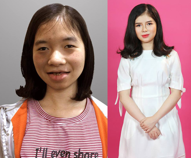Gương mặt mới xinh đẹp của 9X Tiền Giang, Quảng Bình từng bị miệt thị vì xấu