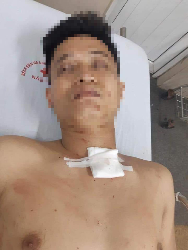 Ninh Bình: Nam thanh niên đâm cô gái trẻ hàng chục nhát rồi tự sát, nghi do mâu thuẫn yêu đương