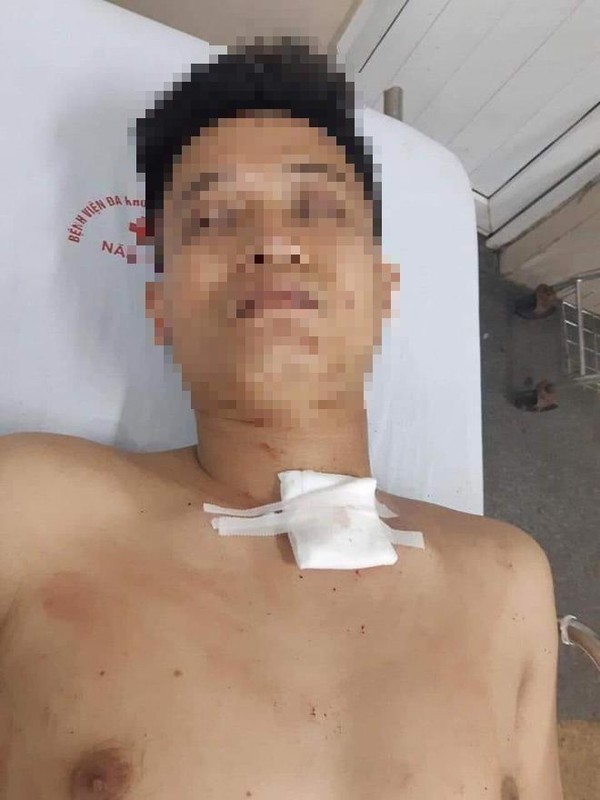 Nam thanh niên truy sát bạn gái rồi tự tử được nhận xét là người điềm đạm, chịu khó làm ăn