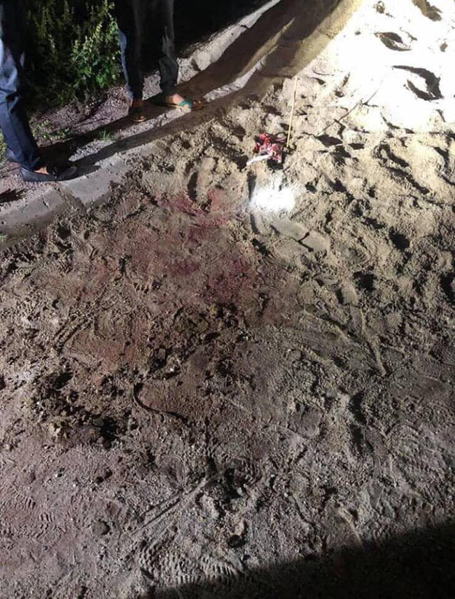 Kinh hoàng bé trai 7 tuổi ở Hưng Yên bị một đàn chó cắn phải nhập viện