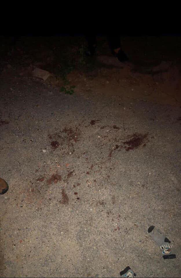 Kinh hoàng bé trai 7 tuổi ở Hưng Yên bị một đàn chó cắn phải nhập viện