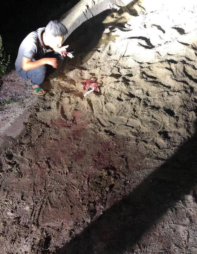 Kinh hoàng bé trai 7 tuổi ở Hưng Yên bị một đàn chó cắn phải nhập viện