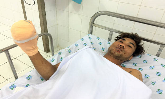 Nam thanh niên suýt mất bàn tay do dùng điện thoại lúc sạc pin