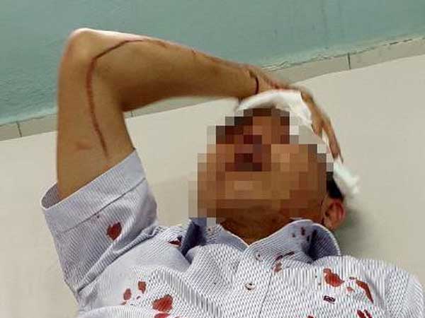 Đậu ôtô trước chung cư, 2 người bị nhóm côn đồ đánh nhập viện