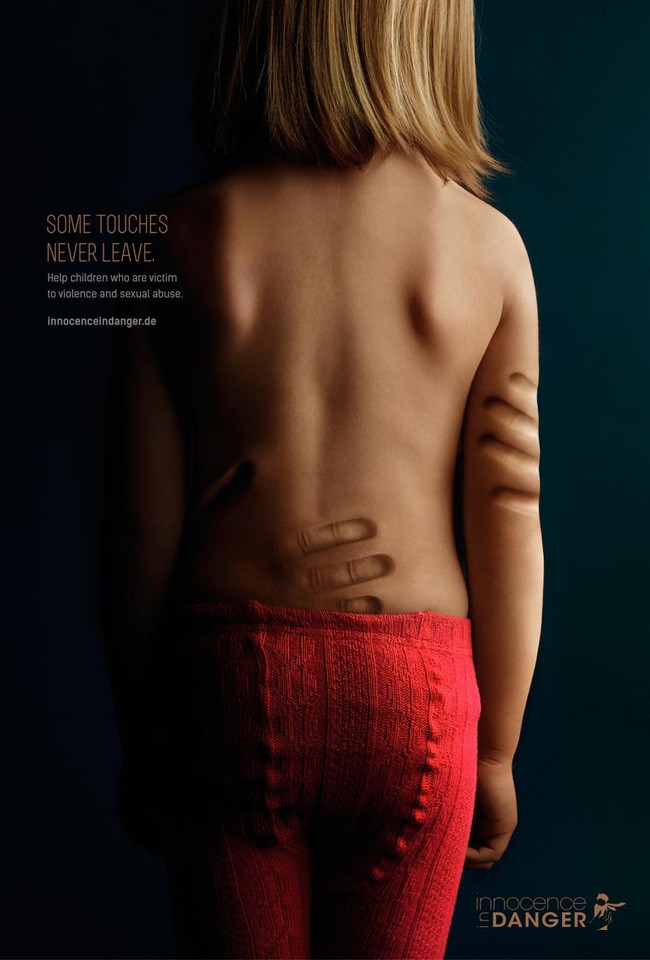 Có những vết nựng hằn sâu suốt cuộc đời – loạt hình ảnh khiến bạn không thể làm ngơ, vì im lặng là đồng lõa với tội ác