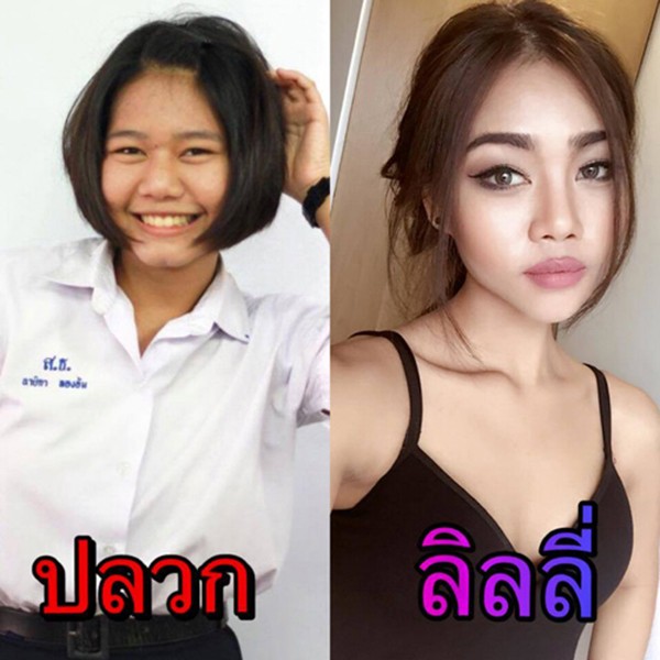 Hot girl bốc lửa Thái Lan bất ngờ công khai ảnh phẫu thuật để có eo con kiến, điều đáng nói đây không phải lần đầu cô lột xác