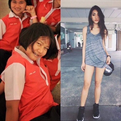 Hot girl bốc lửa Thái Lan bất ngờ công khai ảnh phẫu thuật để có eo con kiến, điều đáng nói đây không phải lần đầu cô lột xác