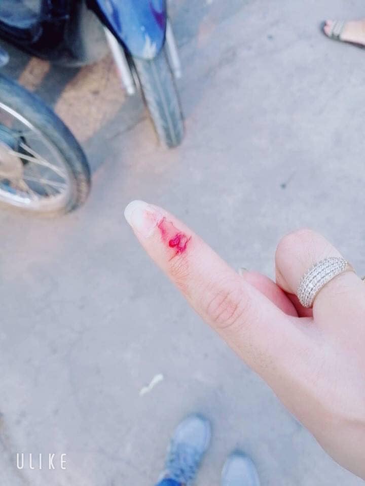 Phẫn nộ với thanh niên đã tranh làn đường còn ra tay hành hung người khác, đáng ngạc nhiên là thái độ của người mẹ Phẫn nộ với thanh niên đã tranh làn đường còn ra tay hành hung người khác, đáng ngạc nhiên là thái độ của người mẹ