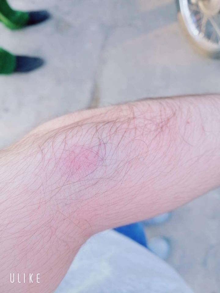 Phẫn nộ với thanh niên đã tranh làn đường còn ra tay hành hung người khác, đáng ngạc nhiên là thái độ của người mẹ Phẫn nộ với thanh niên đã tranh làn đường còn ra tay hành hung người khác, đáng ngạc nhiên là thái độ của người mẹ