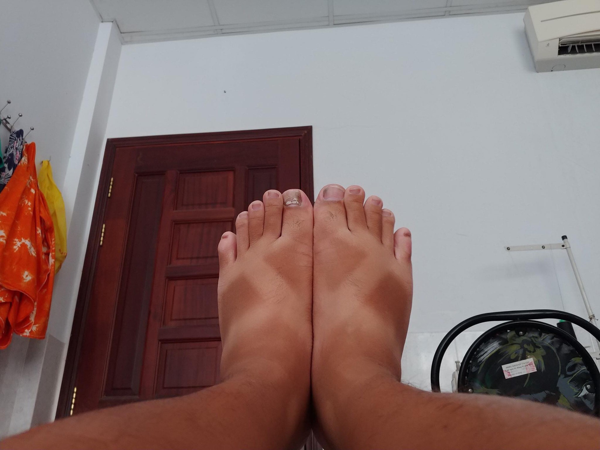 Sài Gòn thất thủ với nắng nóng: Cộng đồng mạng than khóc vì hở ra ngoài chỗ nào là đen ngay chỗ đó