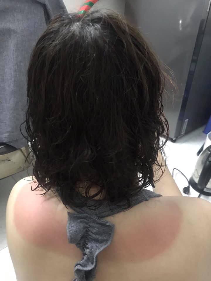 Sài Gòn thất thủ với nắng nóng: Cộng đồng mạng than khóc vì hở ra ngoài chỗ nào là đen ngay chỗ đó