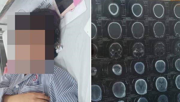 Nữ sinh Quảng Ninh bị đánh nhập viện không phải bạo lực học đường