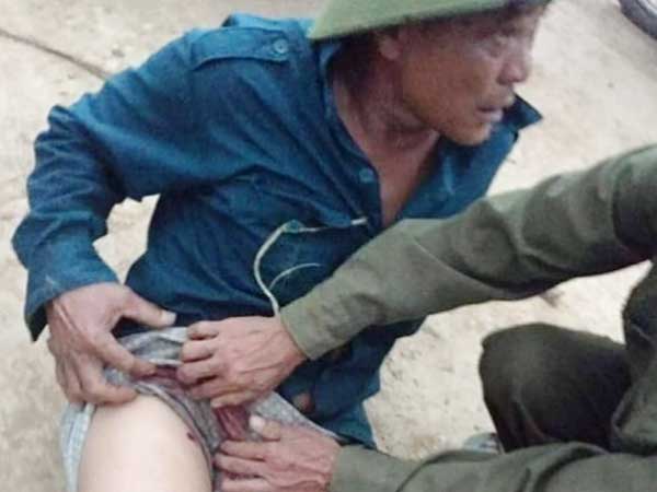 Tạm giữ hình sự kẻ đi xe hơi dùng súng bắn trưởng thôn
