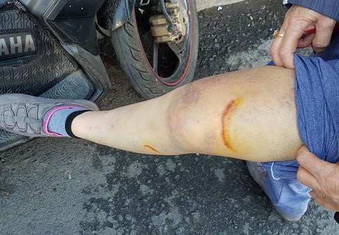 Người nước ngoài đi ôtô cướp tài sản, kéo lê nạn nhân 40 m