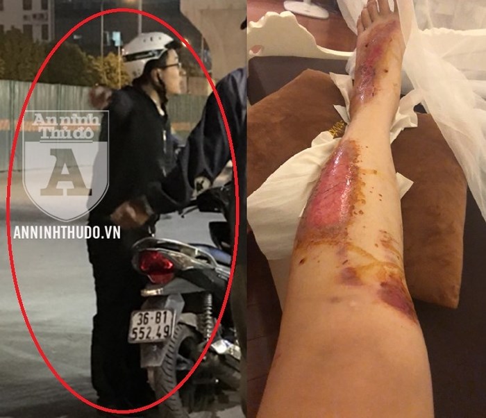 Xuất hiện kẻ bệnh hoạn chuyên xâm hại các cô gái trên đường phố Hà Nội