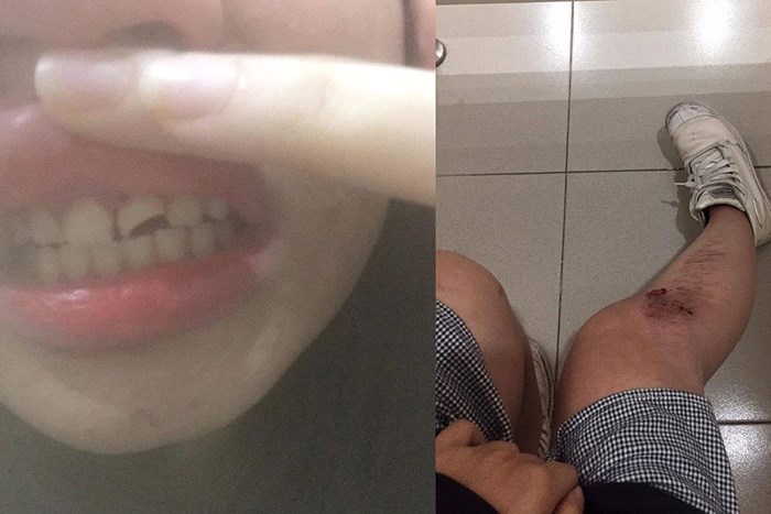 Xuất hiện kẻ bệnh hoạn chuyên xâm hại các cô gái trên đường phố Hà Nội