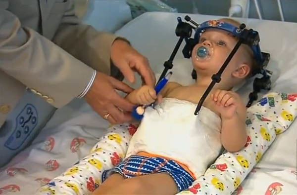 Bé trai 16 tháng tuổi sống sót thần kỳ sau tai nạn lìa đầu